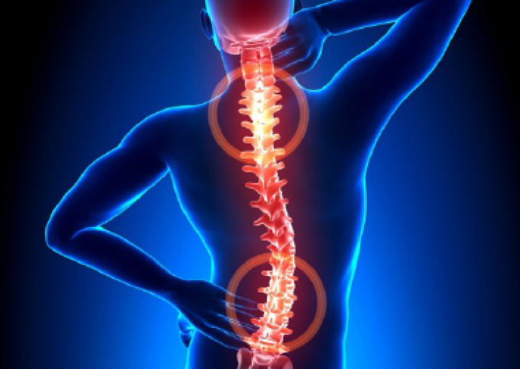 Terapia para el dolor de espalda